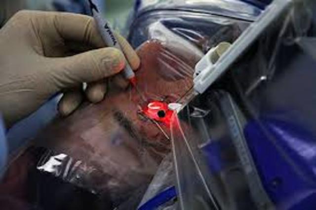 Robots usados en Medicina