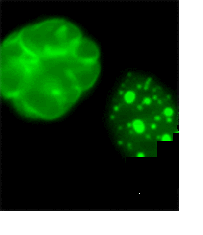 Premature Aging Gene Identified