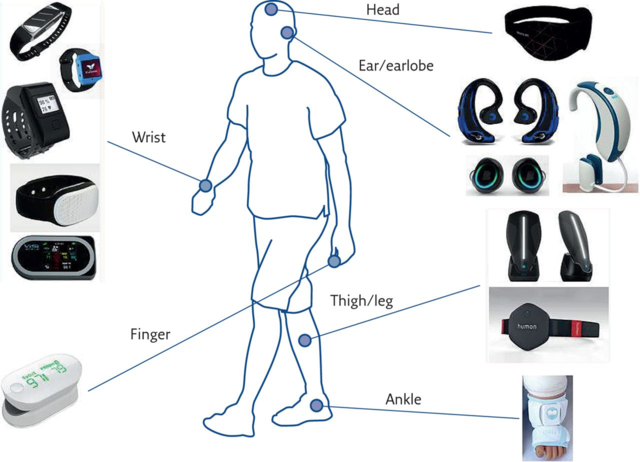 Wearable Technology