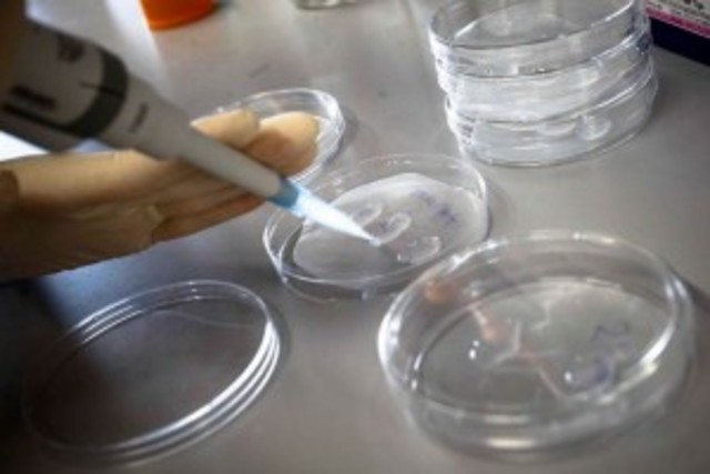 Descubren reacción bioquímica clave en reprogramación celular