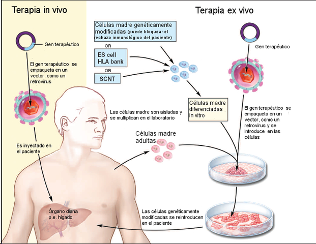 Primer tratamiento de terapia genética con éxito para niños con deficiencia  enzimática.