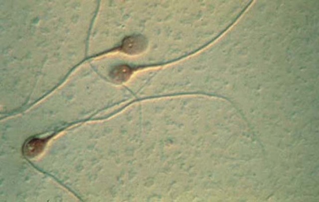 Anton Van Leeuwenhock