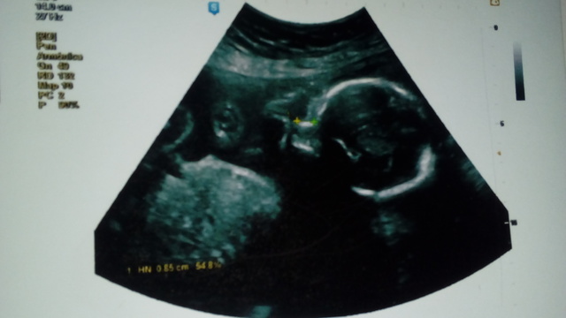 ME ENTERE QUE ESTABA EMBARAZADA