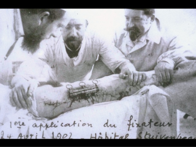 Inicios de la Osteosintesis