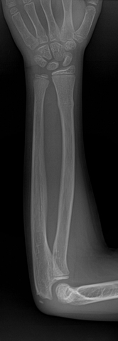 matrimonio de mis tios