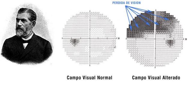 Se comienza a utilizar el término campimetria