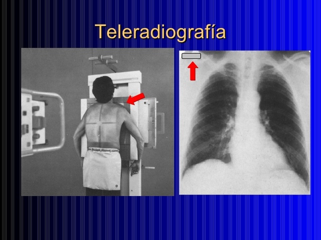 Inicion de la telerradiología en España