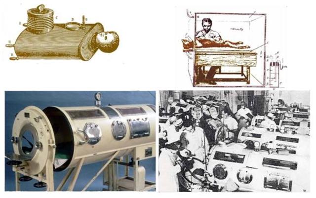 Creación de los primeros respiradores