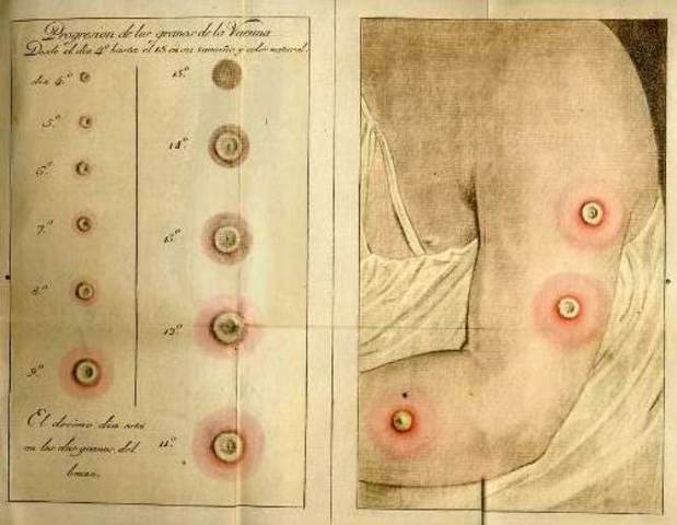 NUEVA EPIDEMIA DE VIRUELA