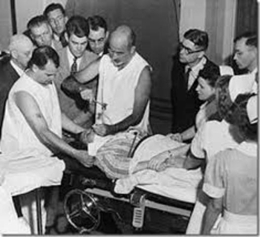 Primera lobotomía prefrontal