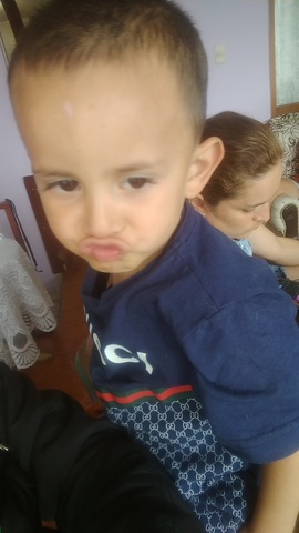 se me cayeron los dientes