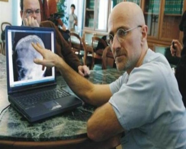 Trasplante de cabeza