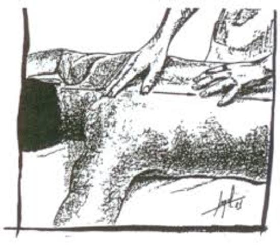 La Fisioterapia durante el Renacimiento