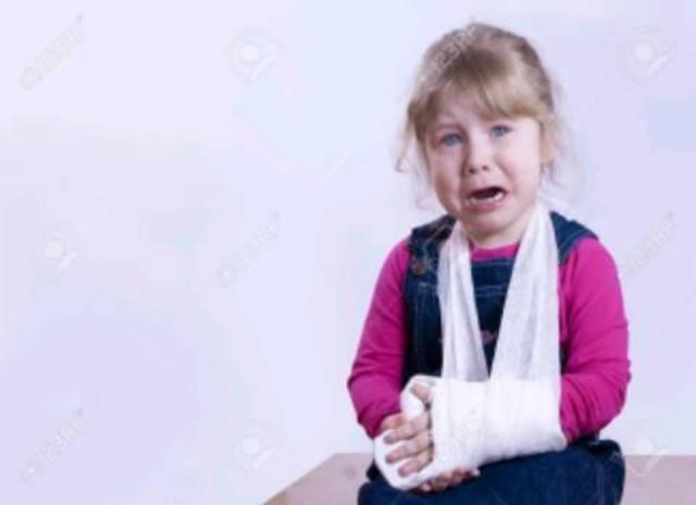 mi primera fractura de un hueso