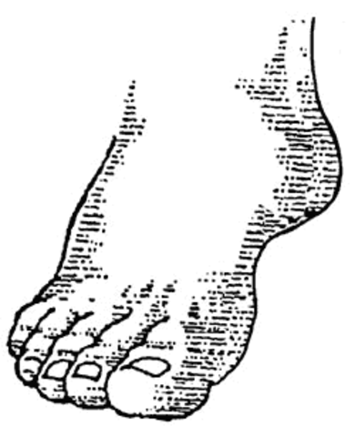 Foot