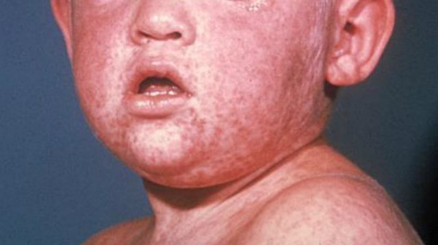 Medicine in the 1920s