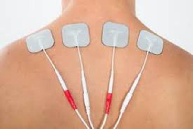 ELECTROTERAPIA