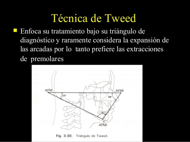 técnica de canto tweed