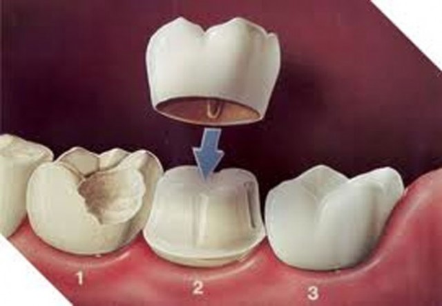 beginning of dentistry