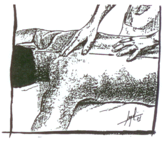 ANTECEDENTES HISTÓRICOS DE LA FISIOTERAPIA DURANTE EL RENACIMIENTO