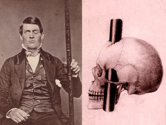 Descubrimiento de la función del lóbulo frontal