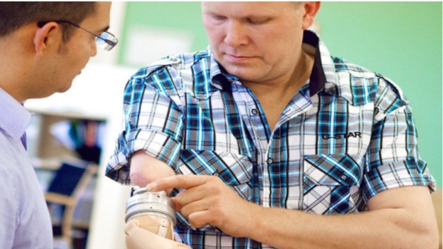 Una mano artificial controlada por el cerebro.