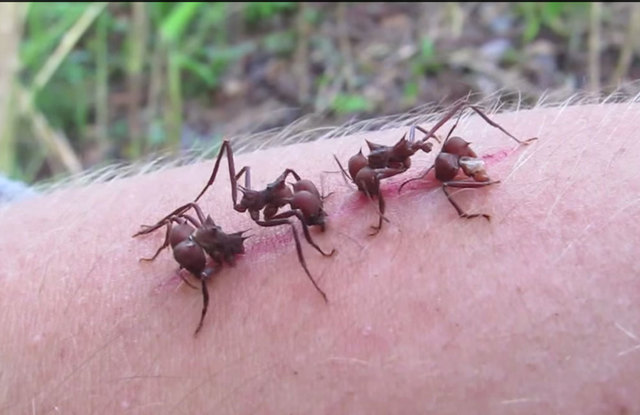 Periodo Neolitico: Suturas en la antiguedad