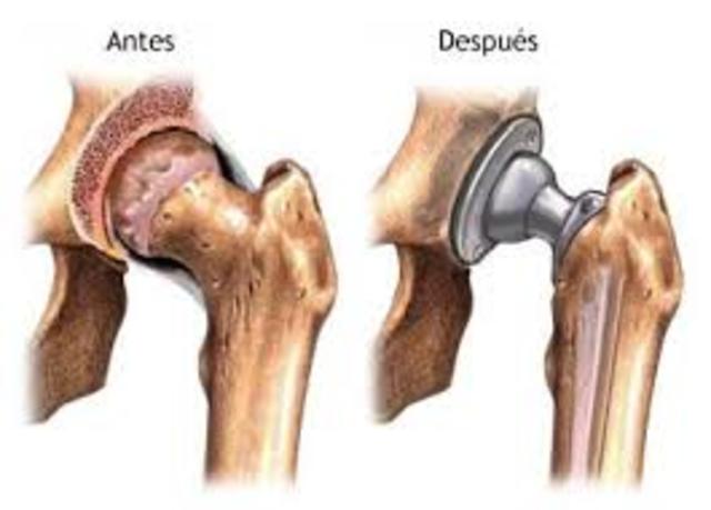 Edad Contemporanea Biocompatibilidad