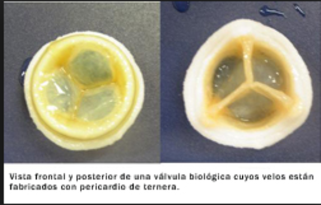 Edad Contemporánea: Válvulas Cardíacas