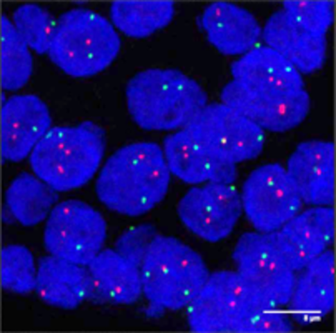 Patología subcelular y molecular