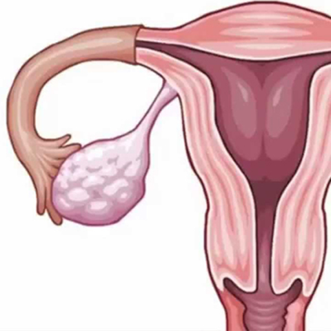 Asociación mexicana de Ginecología y Obstetricia
