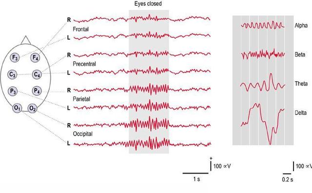 Electroencefalograma