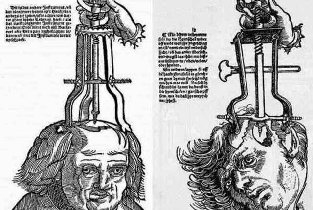 Trepanación ((Von Hopffgarten, Anna, revista mente y cerebro No. 73)