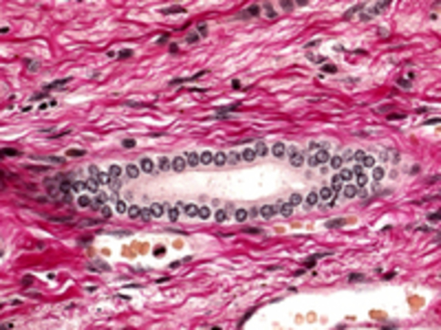 EL ADN EN LAS CÉLULAS