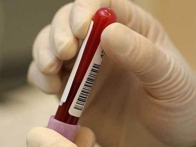 Inicia la prueba sérica materna para la detección prenatal