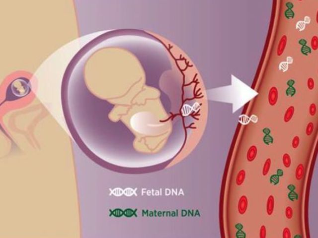 Detección del DNA fetal en sangre materna