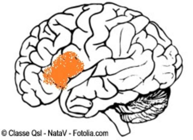 Broca y su concepto de la afemia