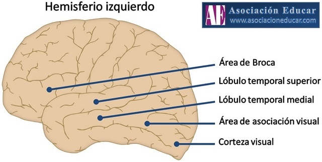 Broca y su concepto del hemisferio izquierdo