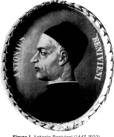 Antonio Benivieni