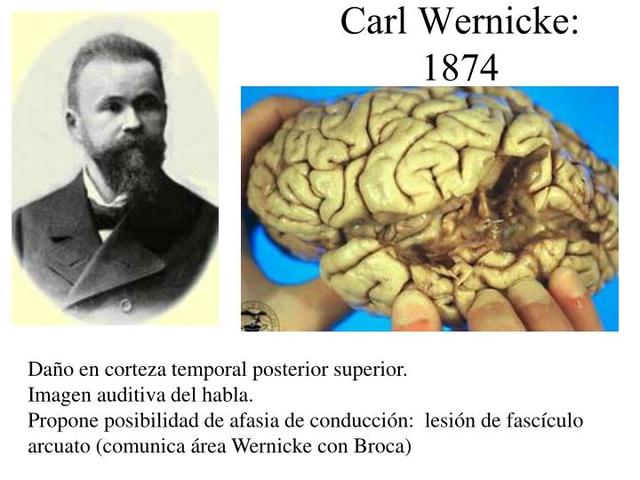 Karl Wernicke "Teoría de la Función Cerebral"