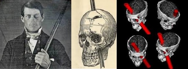 Phineas Gage y el enigma del córtex prefrontal (Elsevier.es - A. garcía-Molina - 2012)