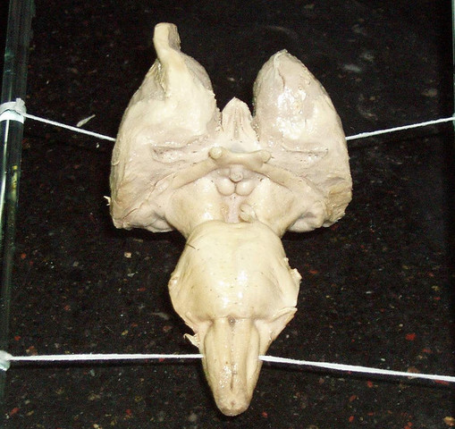 Tronco del encéfalo, diencéfalo, cerebelo y sus capas