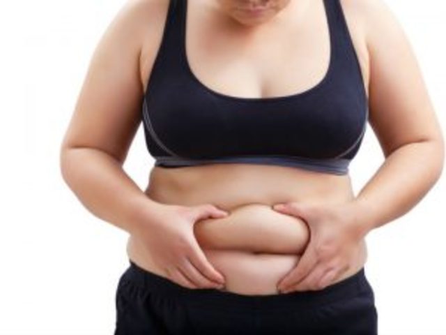 Se le diagnostico Obesidad