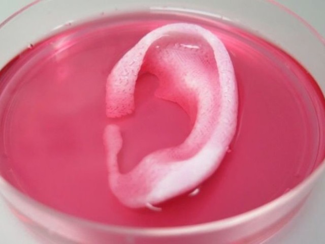 Primer trasplante de órgano completamente cultivado.