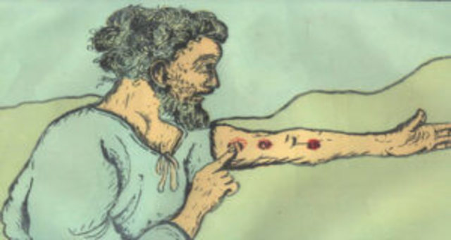 Primeros diagnósticos de Lepra