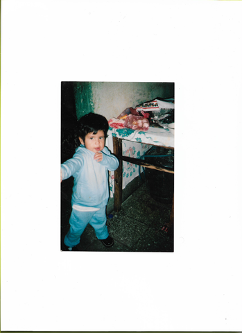 Operación - IGSS Pediatría