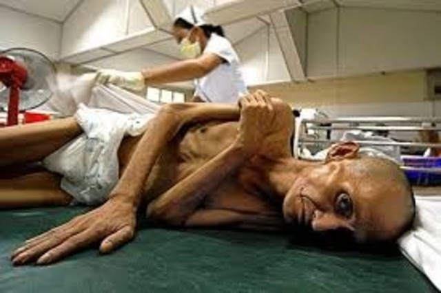 Top 5. VIH SIDA (Más de 25 millones)