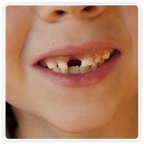 è caduto il primo dentino