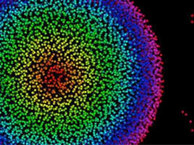 Microscopic detection of sperm