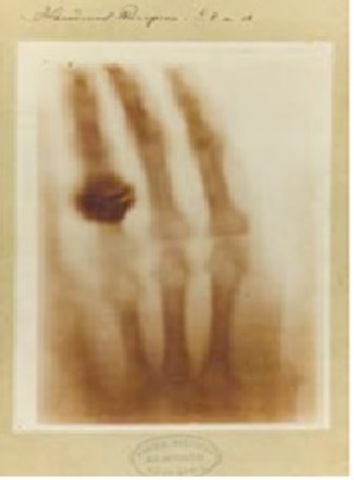 Wilhelm Conrad Röntgen (1845-1923).